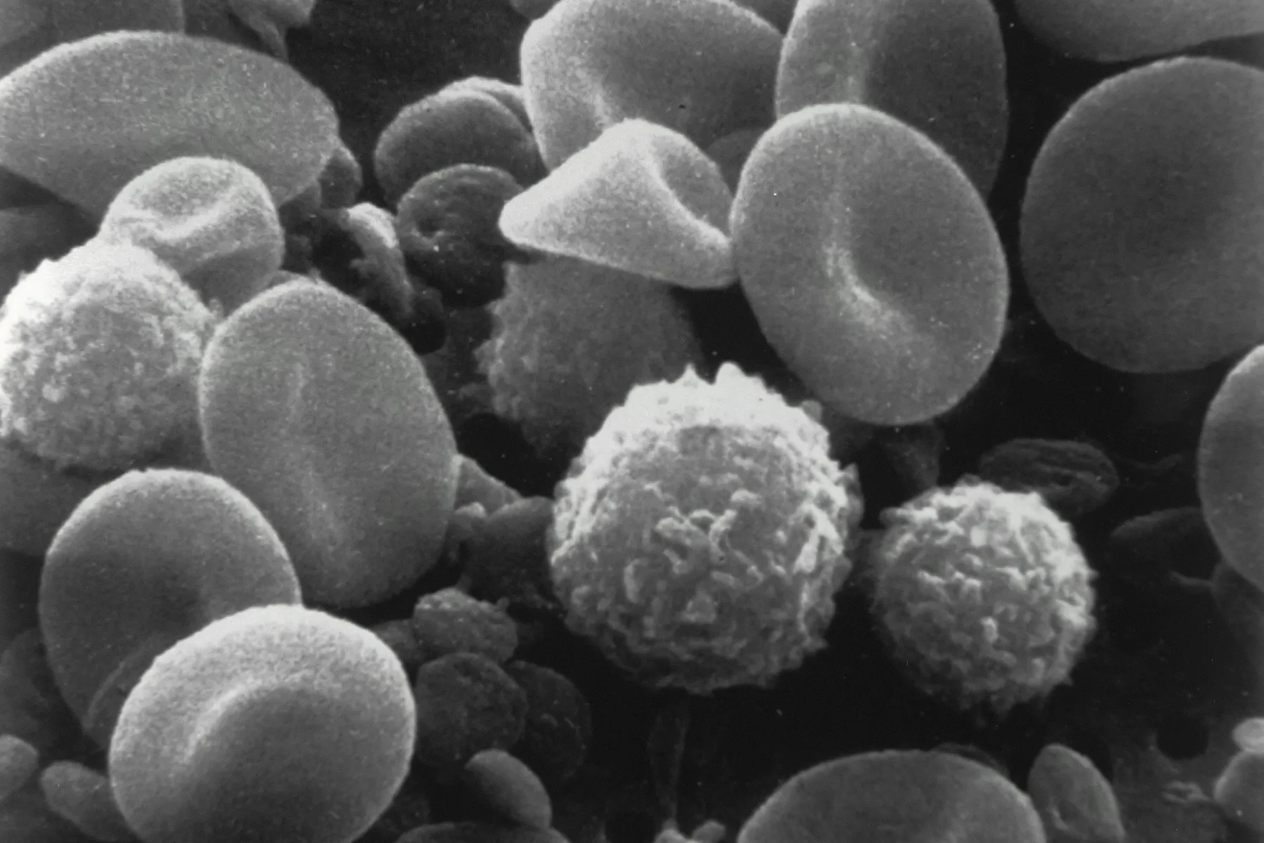Image of blood cells