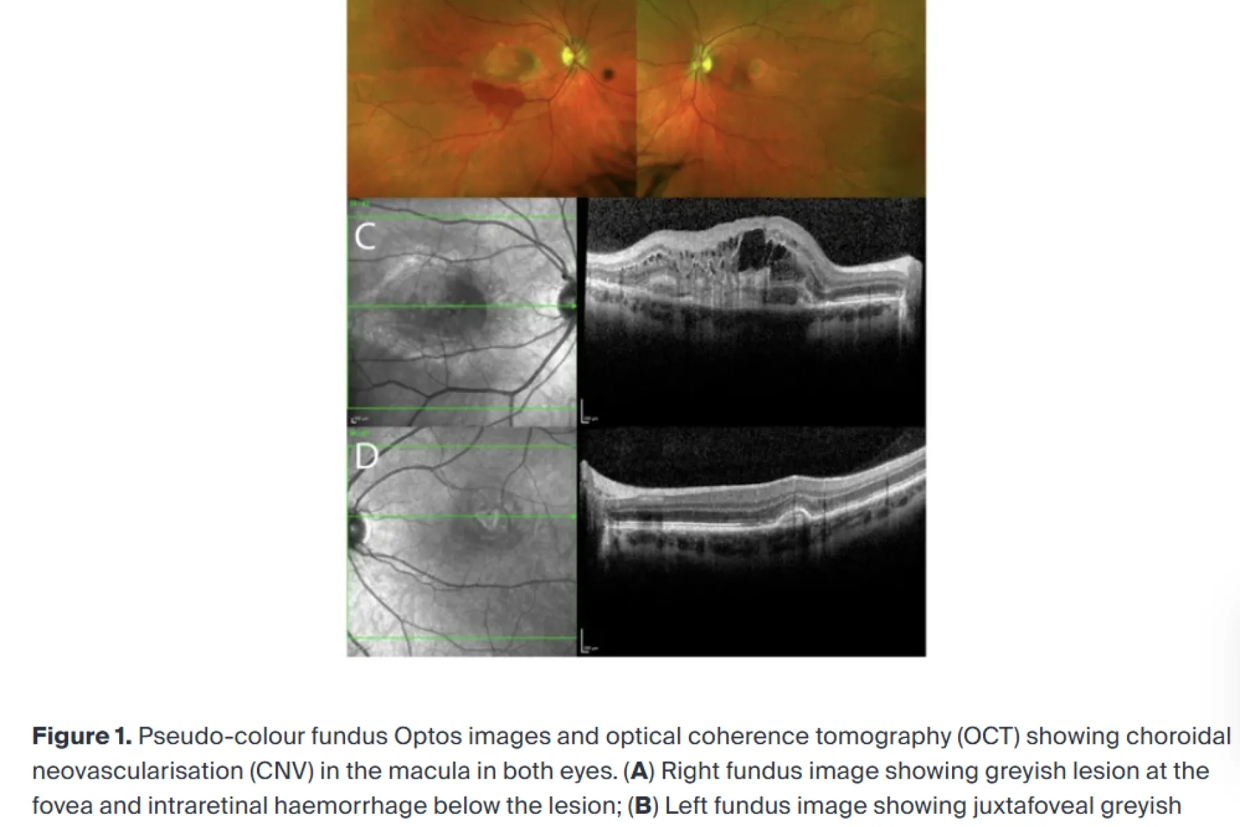 Thumbnail of figure from paper